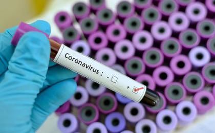 Coronavirus: salgono i casi positivi nella zona rossa della Val Fino
