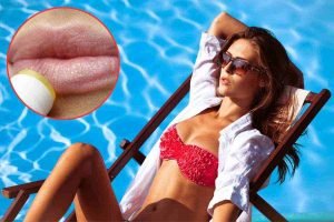 Proteggi le tue labbra in estate con il lip balm