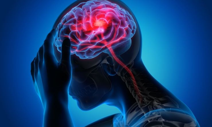 caldo estremo neurologo come evitare danni cervello