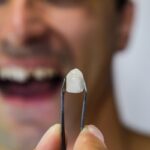 Uomo che mostra il dente caduto