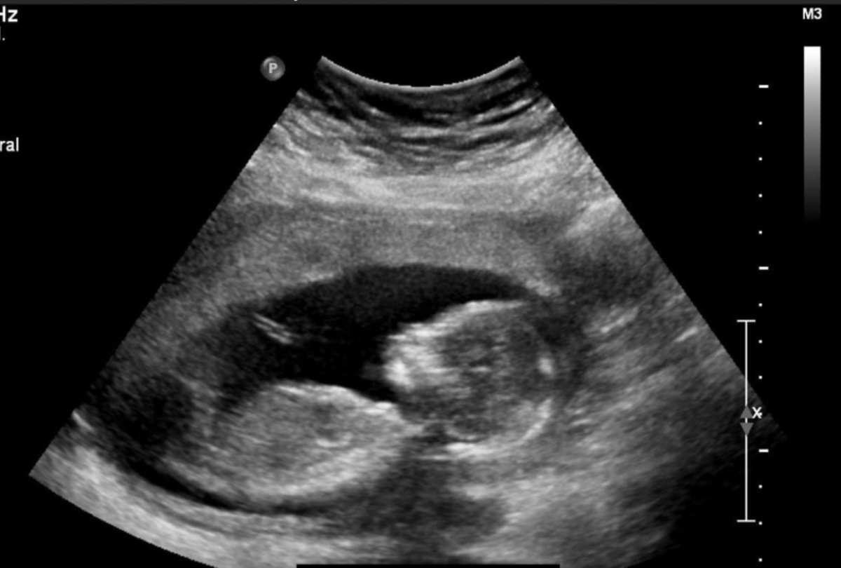 Una delle star più amate