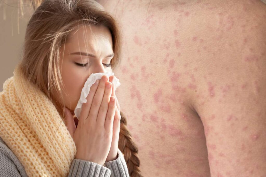 Ragazza si soffia il naso e schiena con macchie rosse