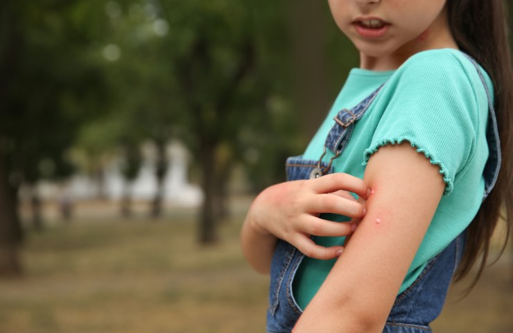 bimba si gratta il braccio