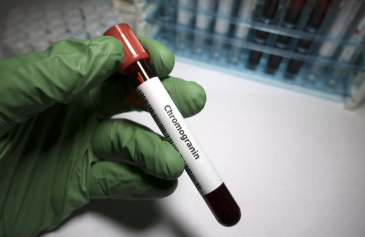 provetta stretta in una mano guantata