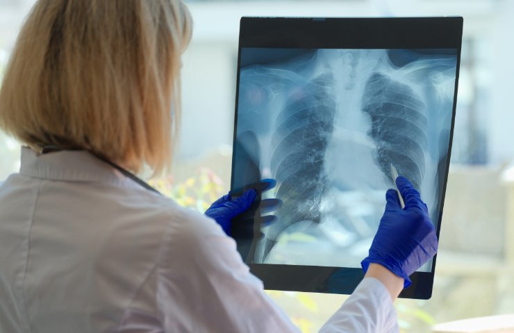 Radiografia al torace