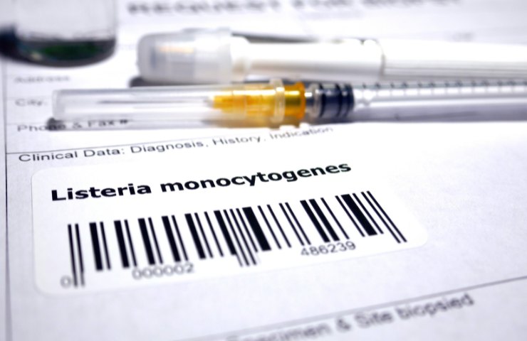 Diagnosi di Listeriosi
