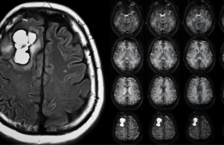 Immagini rappresentanti un cervello